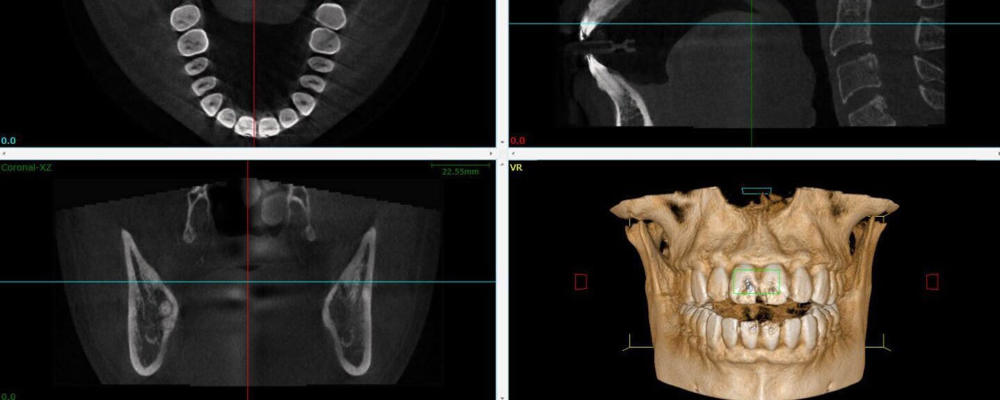 3D cone beam, dental technology