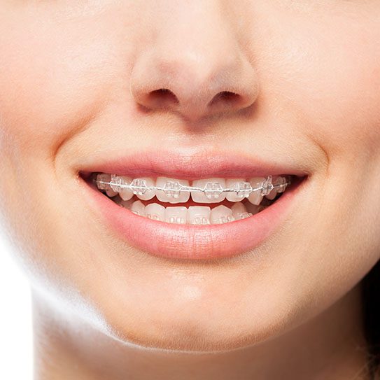 orthodontist near me adult braces orthodontist NJ